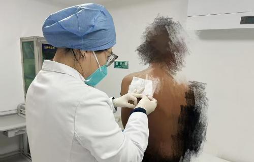 医病更疗心，传染科为艾滋病患者撑起希望之伞