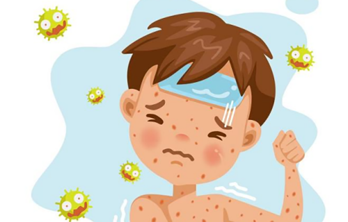 麻疹防控小知识，家长请查收