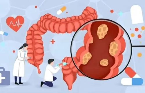 世界肠道健康日 | 夏季饮食需警惕，预防感染性腹泻有妙招